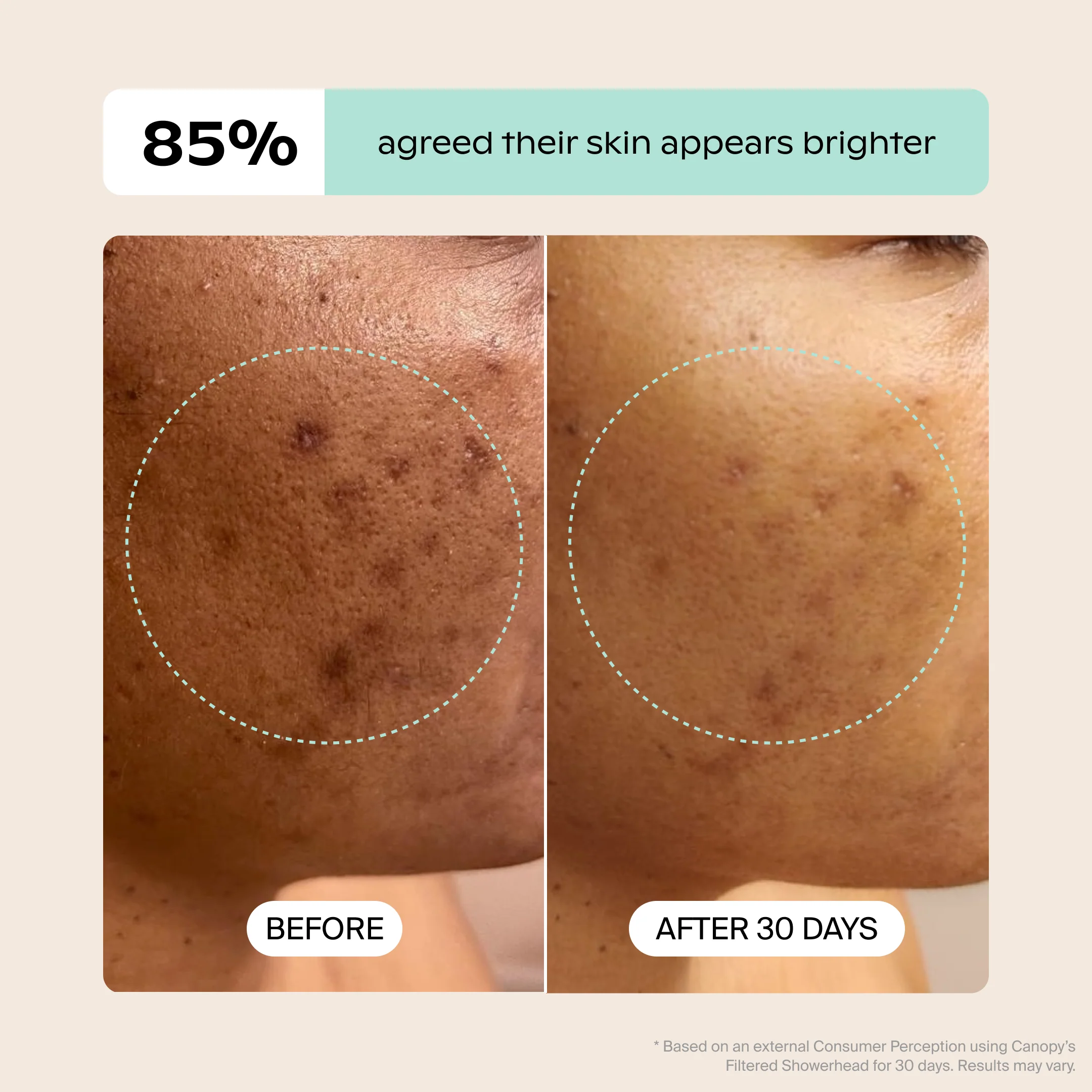 Handheld Filtered Showerhead Bundle - Image 11